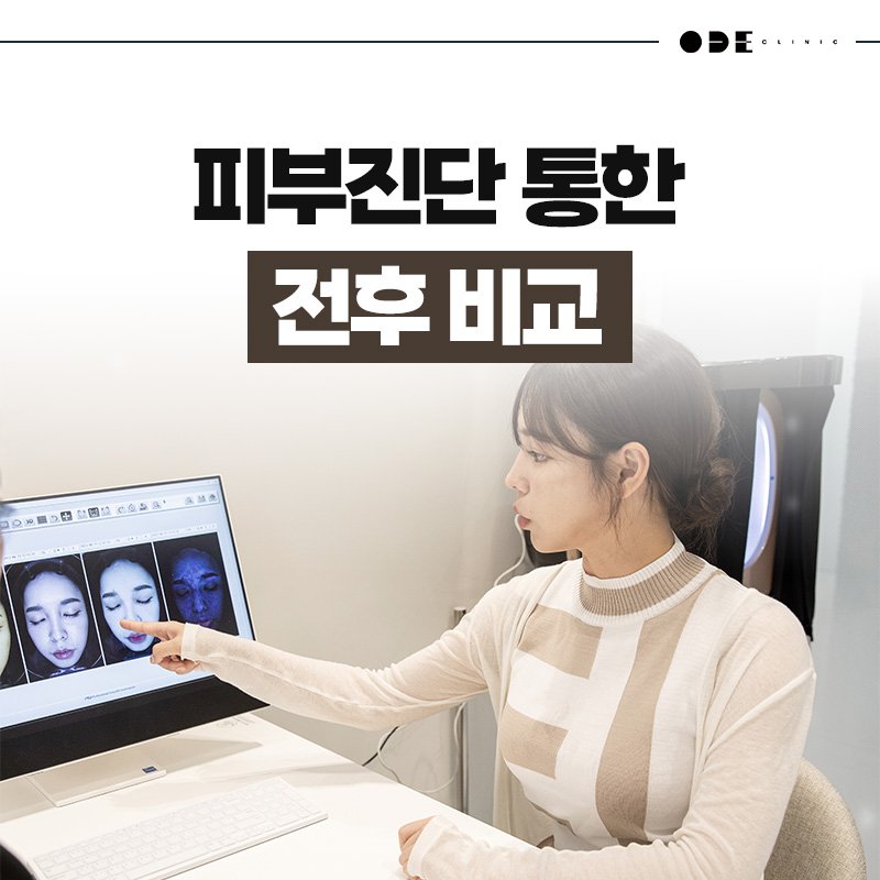 주입 깊이